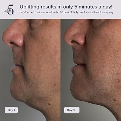 skin tightening results with lifting and firming device